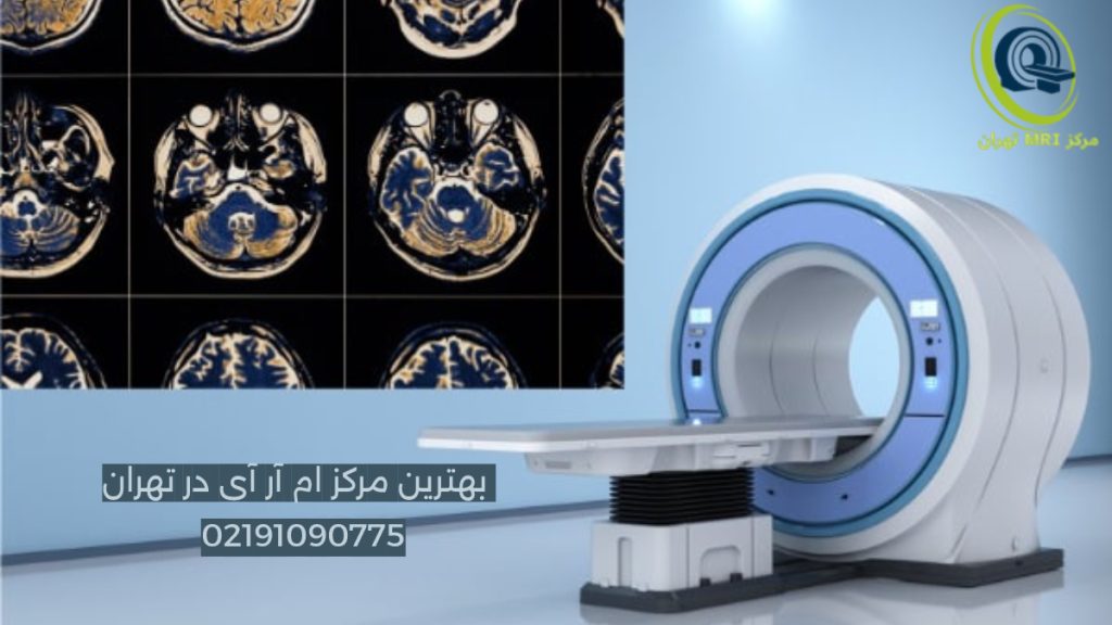تصویری از دستگاه ام آر ای به همراه جواب ام آر آی مغز در گوشه تصویر و شماره بهترین مرکز ام ار آی تهران 