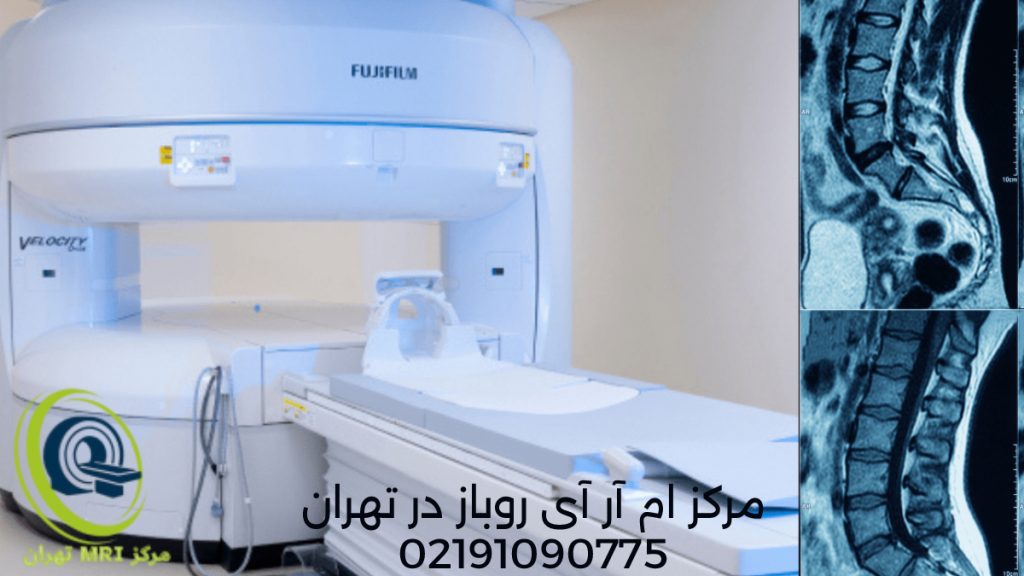 open mri تصویری از دستگاه ام آر آی روباز در کنار جواب ام ار ای ستون فقرات