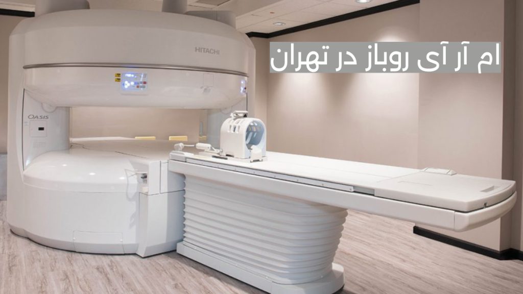 open mri تصویری از دستگاه ام آر آی روباز در تهران