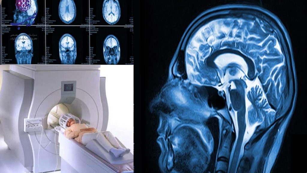 brain mri تصویری از ام آر آی مغز و بیمار در حال گرفتن ام آر ی مغزی