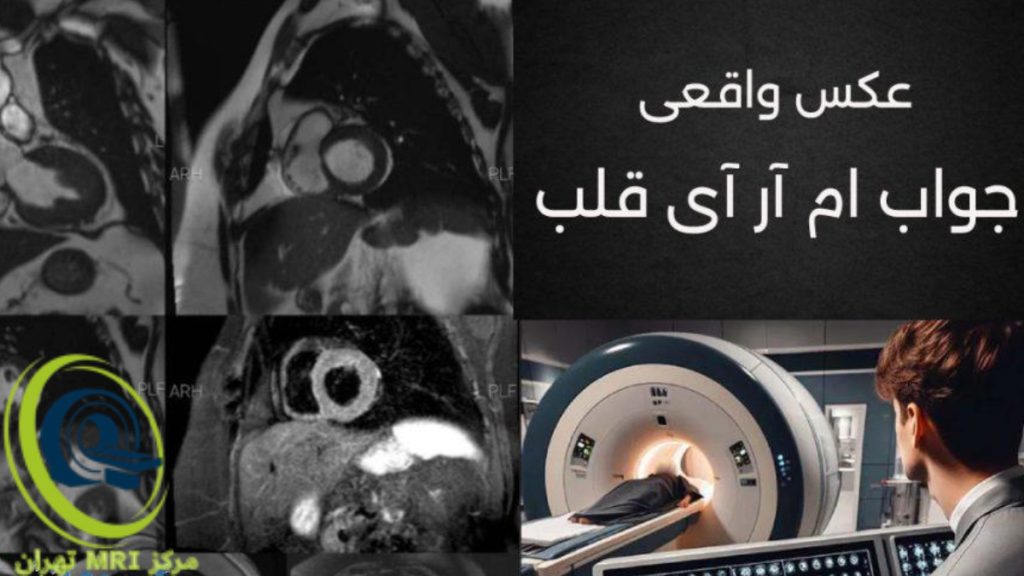 تصویر واقعی از جواب ام آر آی قلب