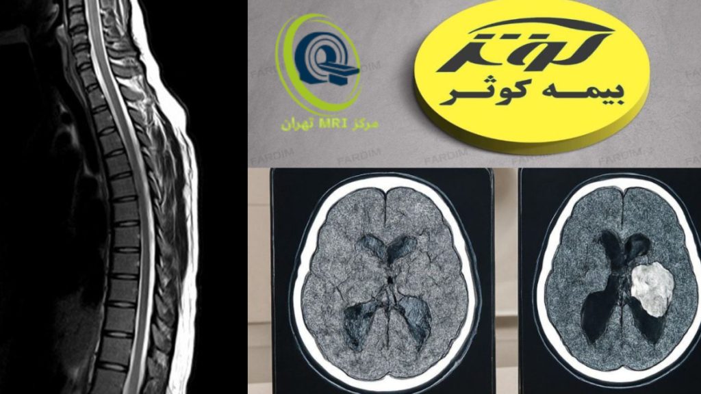 بیمه کوثر ام ار ای تصویر ام ار ای مغزی و ام ار ای کمر به همراه لوگوی بیمه کوثر