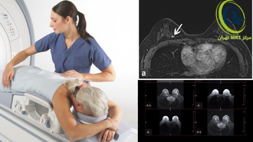 breast mri نحوه انجام ام آر آی پستان