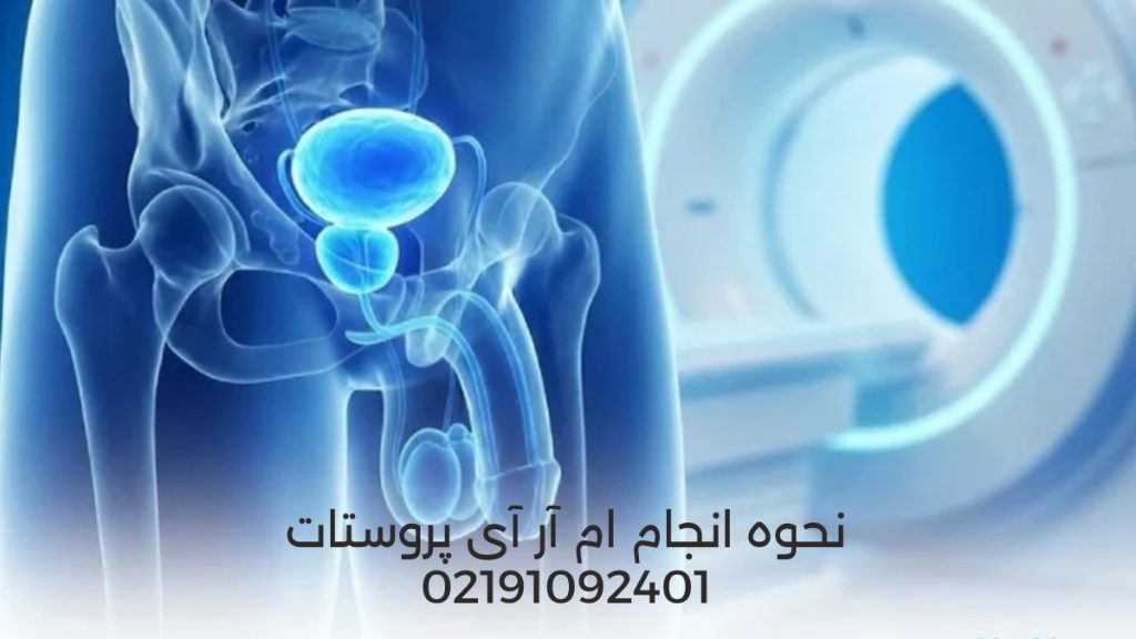 ام آر آی پروستات