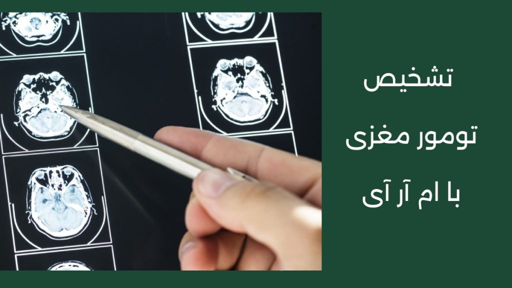 تشخیص تومور مغزی با ام آر آی